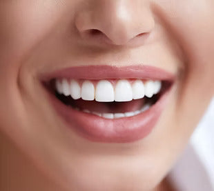 Teeth Whitening 